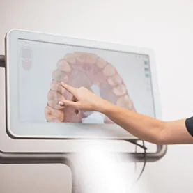 Photo of teeth on machine